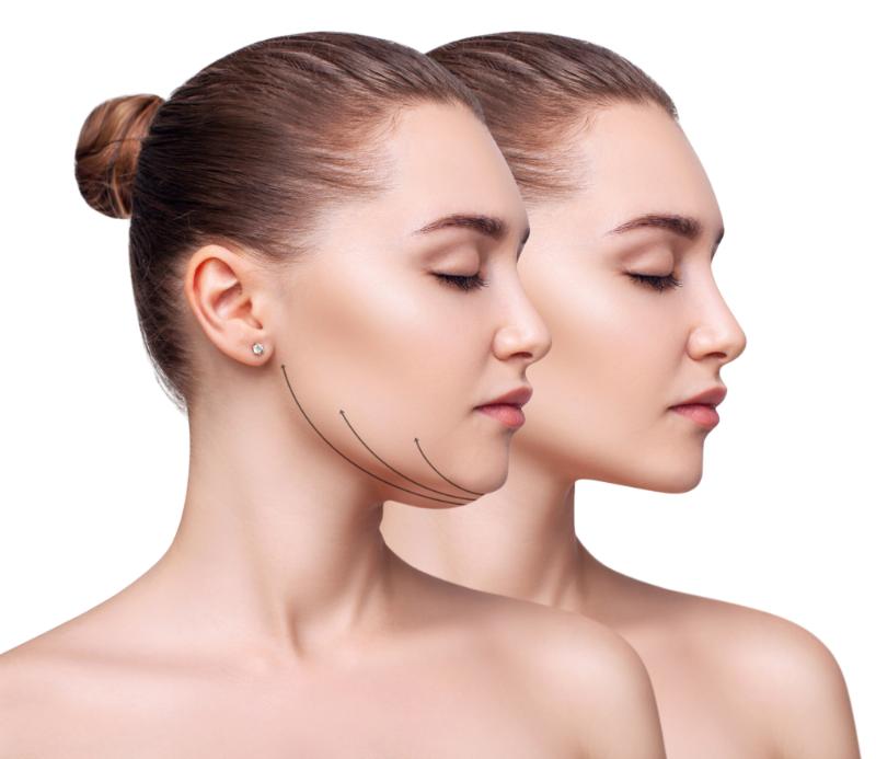 Fat dissolving injections melbourne
