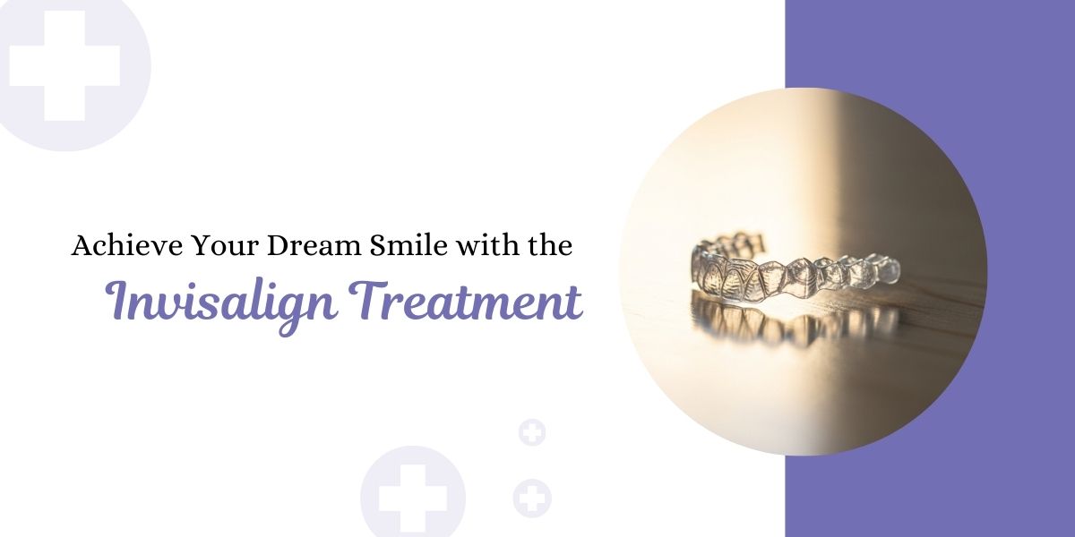 Affordable Invisalign provider in Wimbledon
