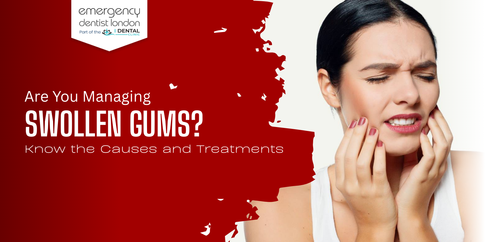 Are You Managing Swollen Gums? Know the Causes and Treatments