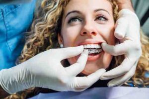 Smilo Dental Implants