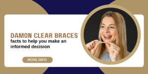 Damon clear braces – facts to help you make an informed decision