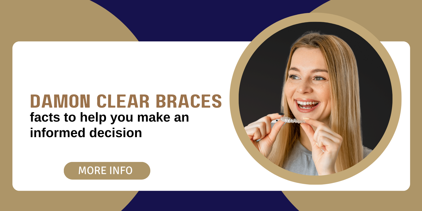 Damon clear braces – facts to help you make an informed decision