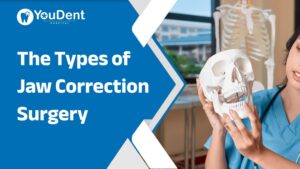 The Types of Jaw Correction Surgery: Upper Jaw, Lower Jaw, and Double Jaw