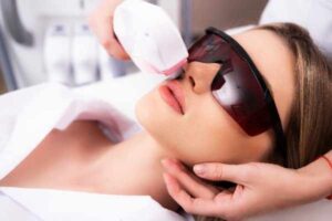 Laser Hair Removal