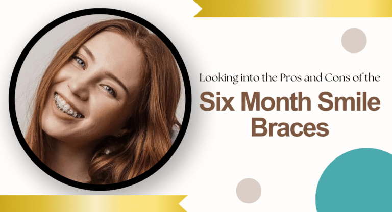 six month smiles cost in London