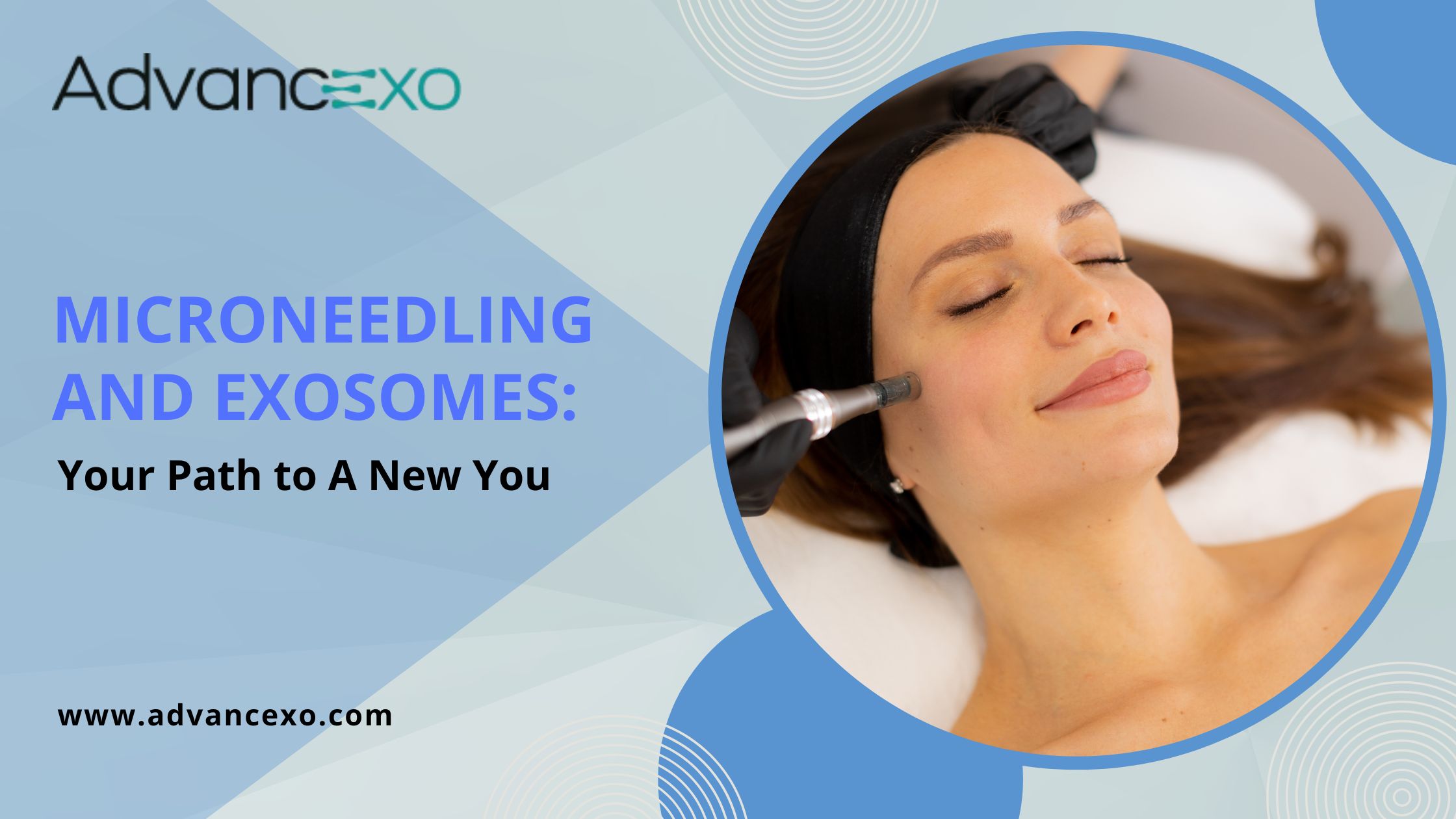 Microneedling-and-Exosomes-Advancexo
