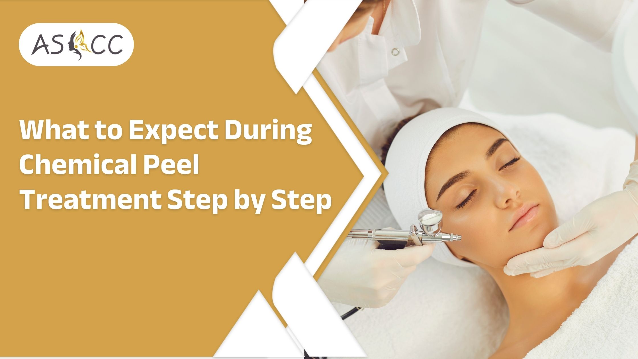 What to Expect During Chemical Peel Treatment Step by Step
