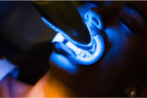 teeth whitening cost London