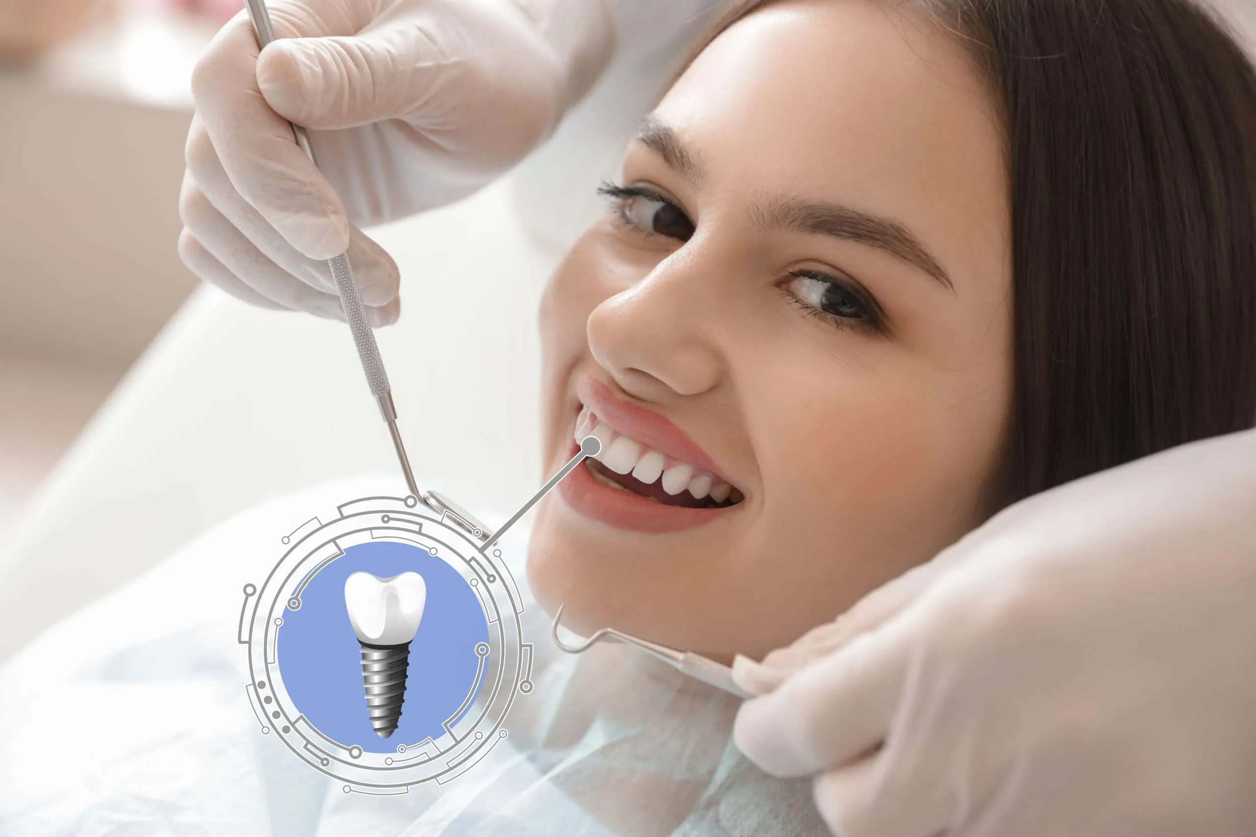 dental implant Derby