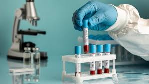 Laboratory Billing Service