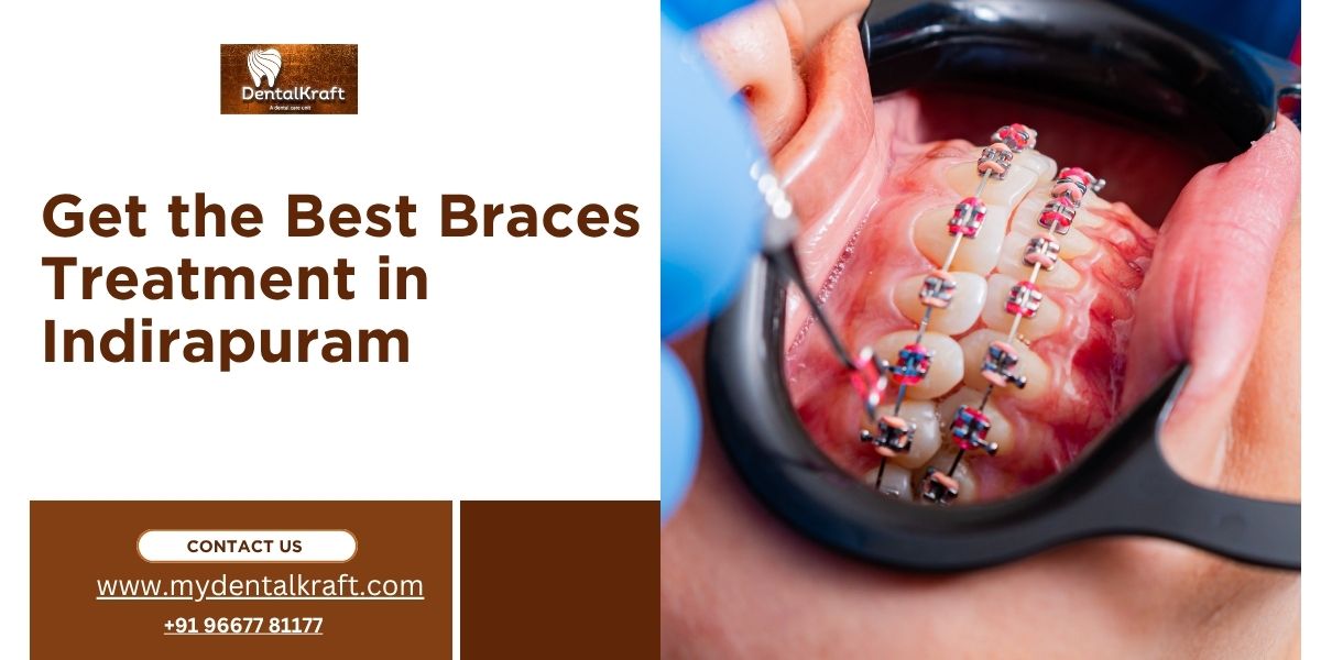Braces Treatment